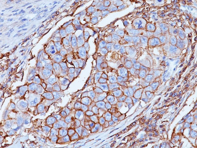 IHC -  CD44 / HCAM Std. Antibody - With BSA and Azide AH12747-20